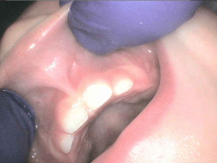 Before Image