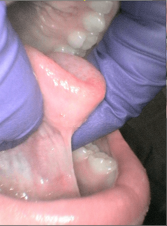 Before Image