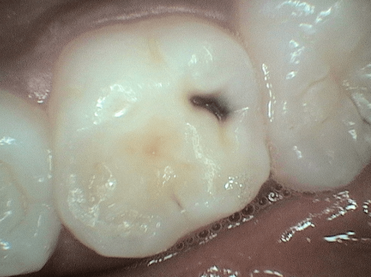 Before Image