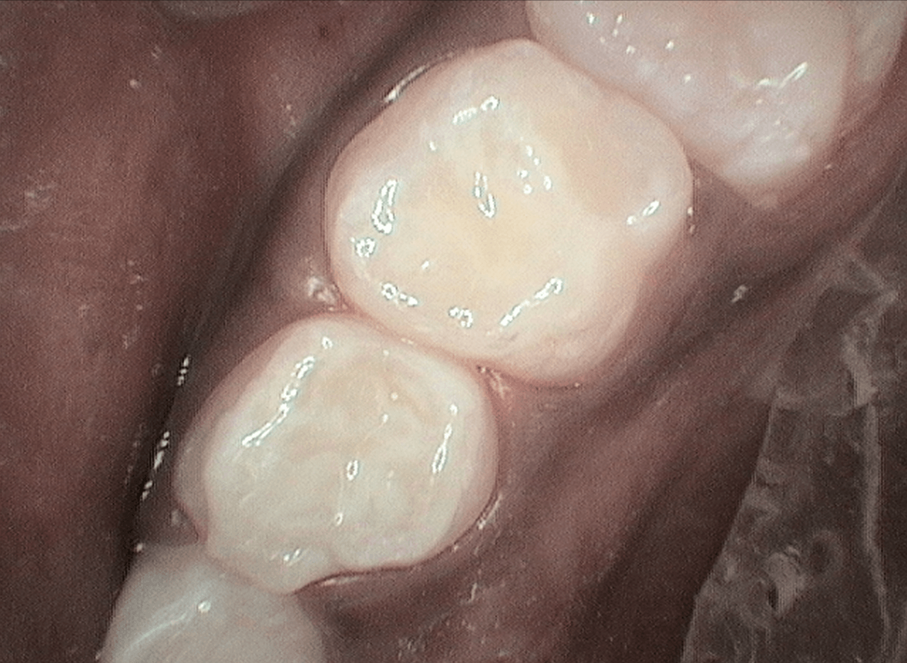 After Image