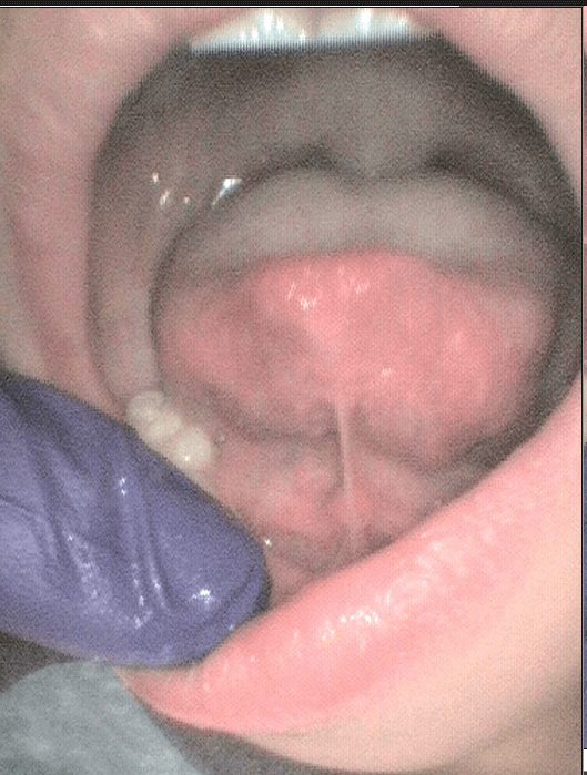 After Image