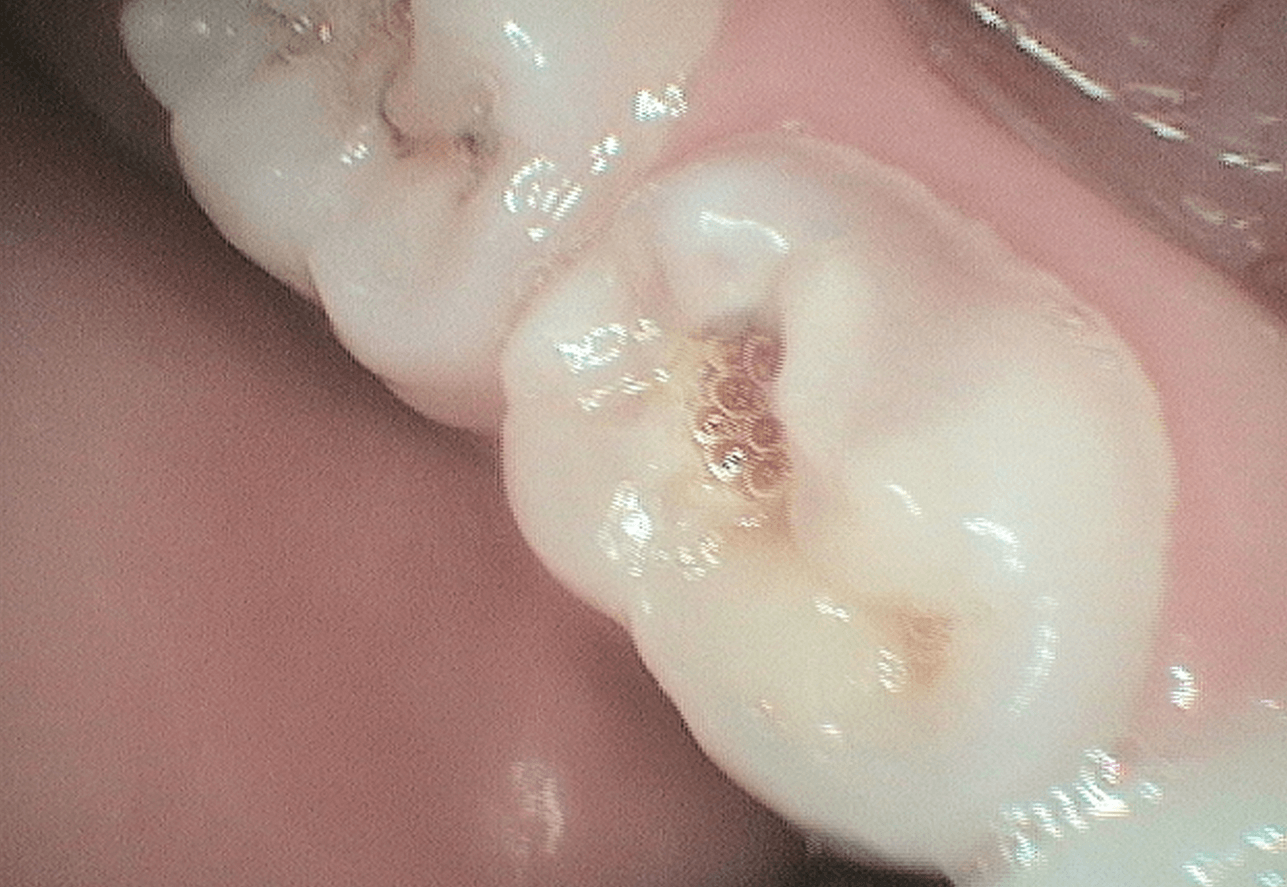 Before Image
