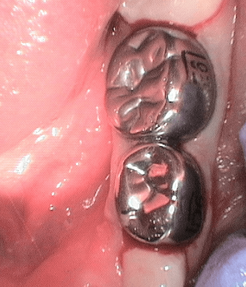 After Image