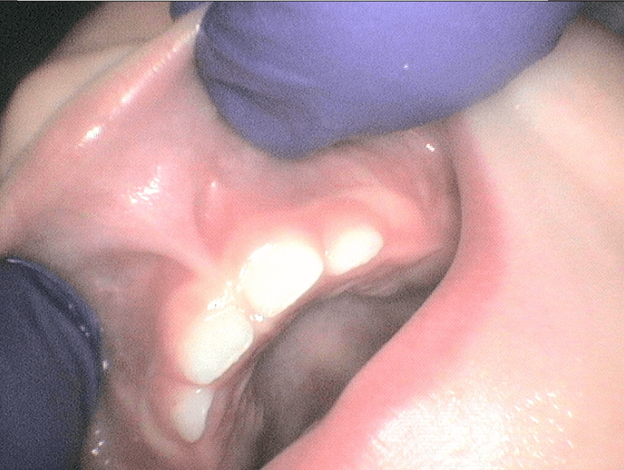 Before Image