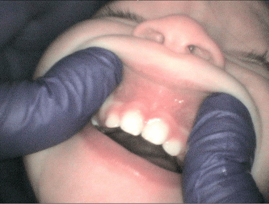 After Image