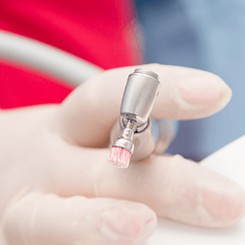Fluoride Treatment